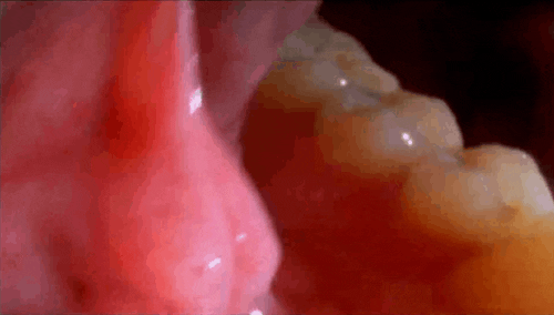 VQYS6AbHYbdsY.gif